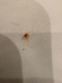 Excrement or blood?
