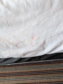 Blood stain on conforter