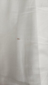 Their bedsheets had blood stains that had been cleaned, but the marks were still there.