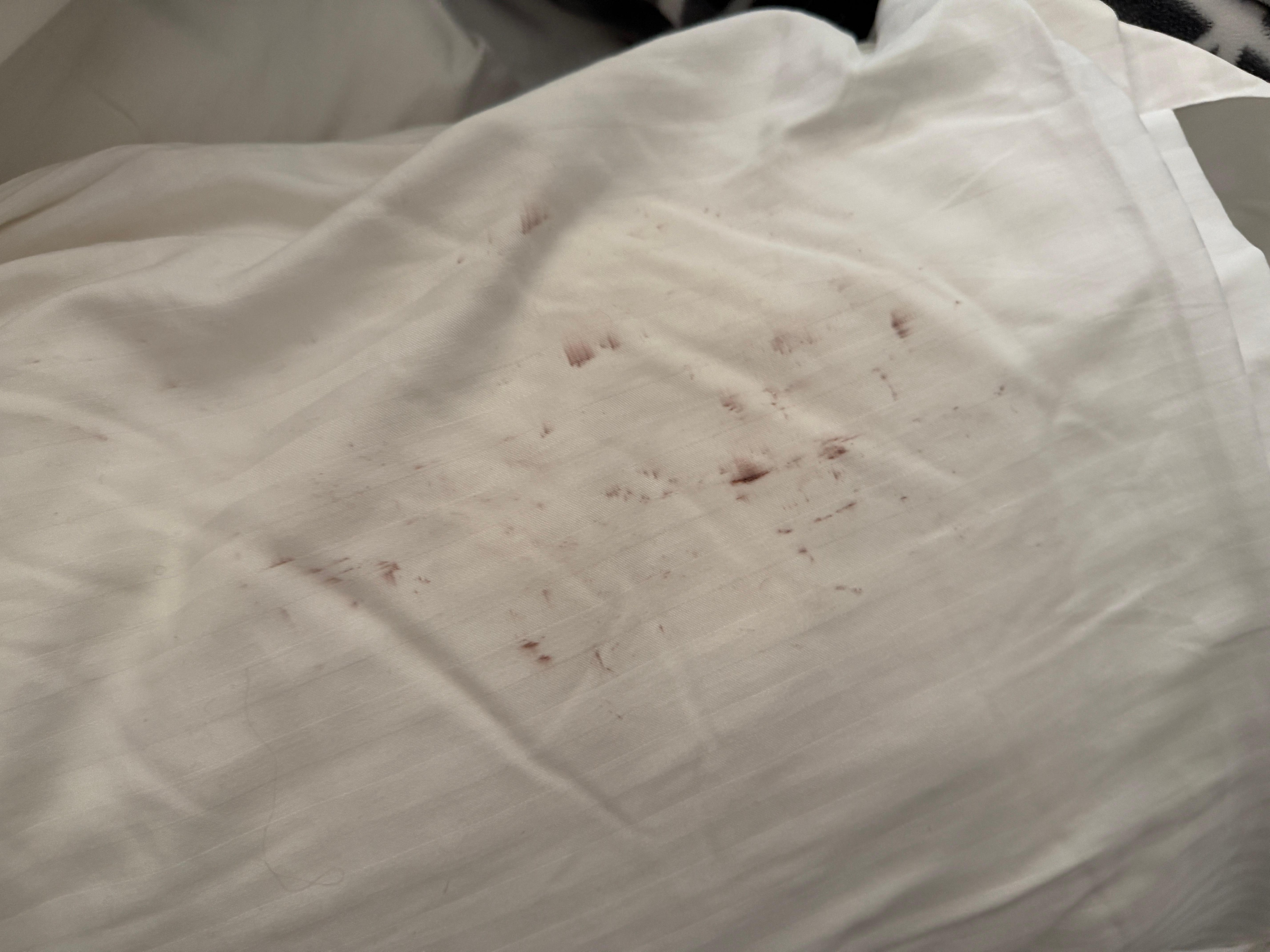 Stains found on pillow case 