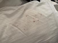 Stains found on pillow case