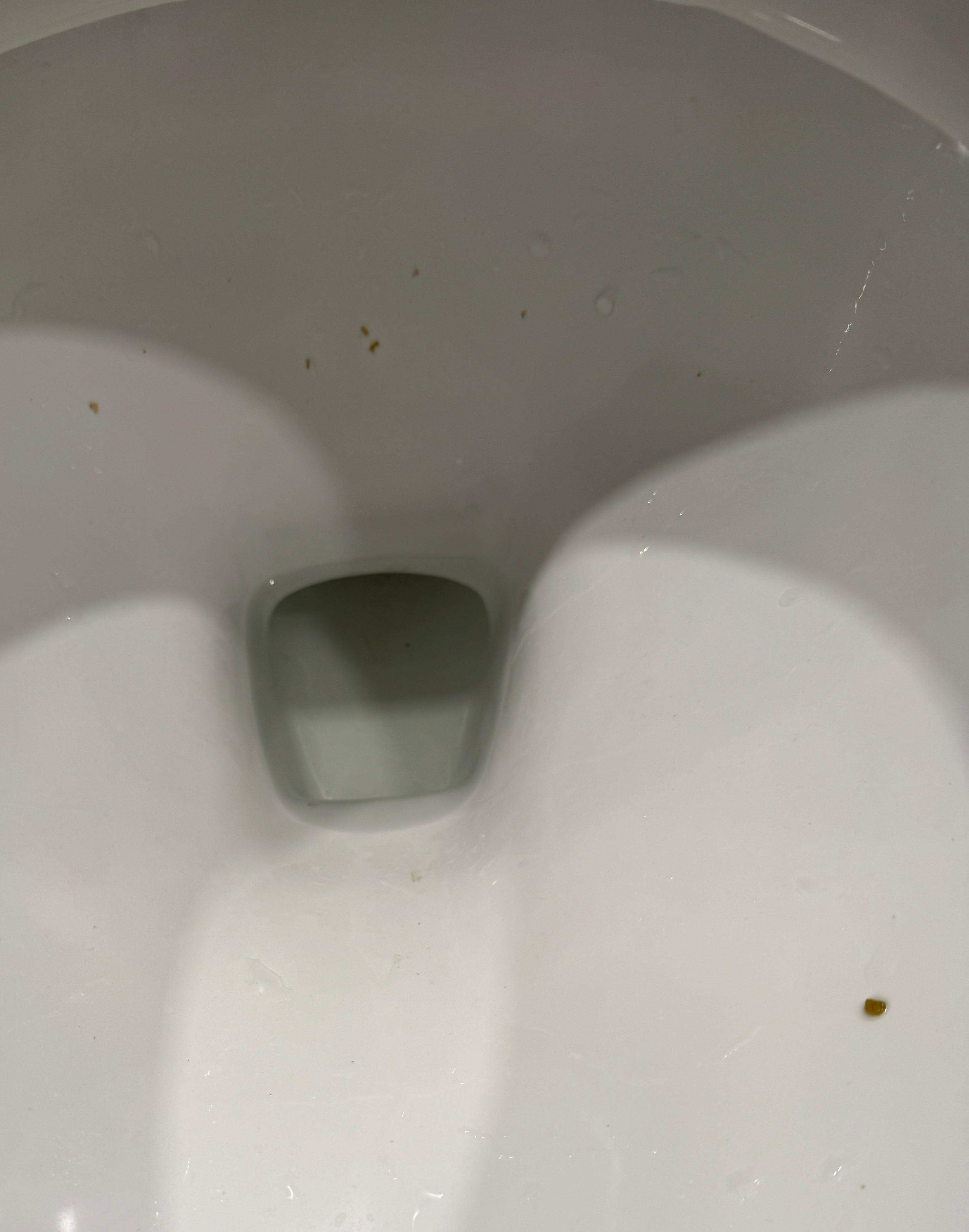 fecal matter in toilet