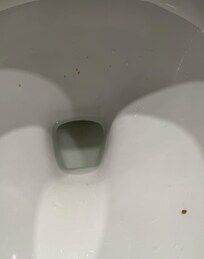 fecal matter in toilet