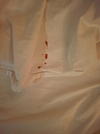 Blood on sheets
