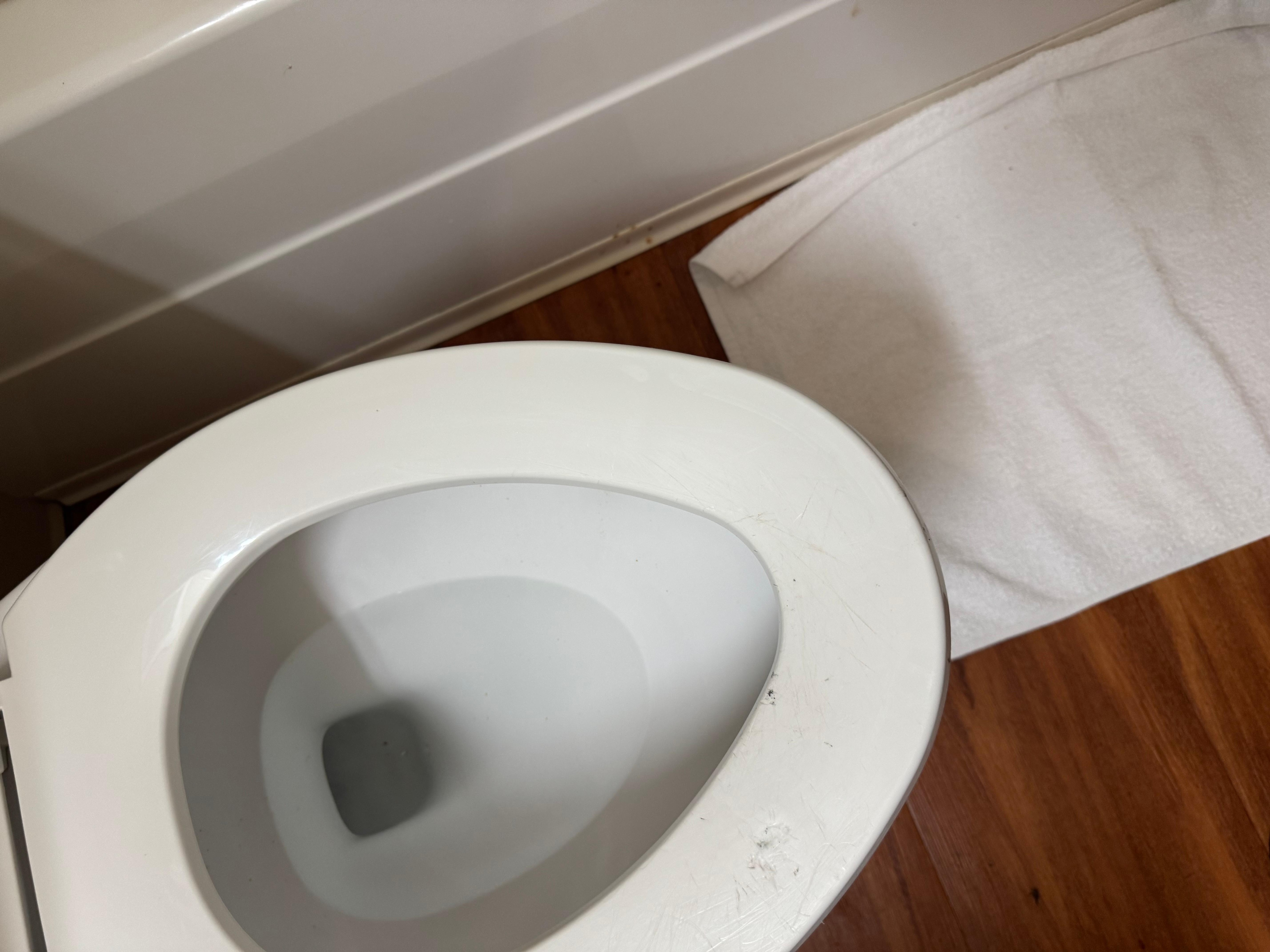 Old dirty stained toilet seat that need replaced