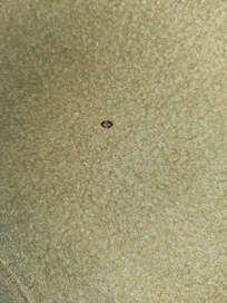 Bed bug