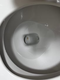 Stained toilet bowl and tub