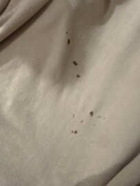 They give people sheets with burn holes