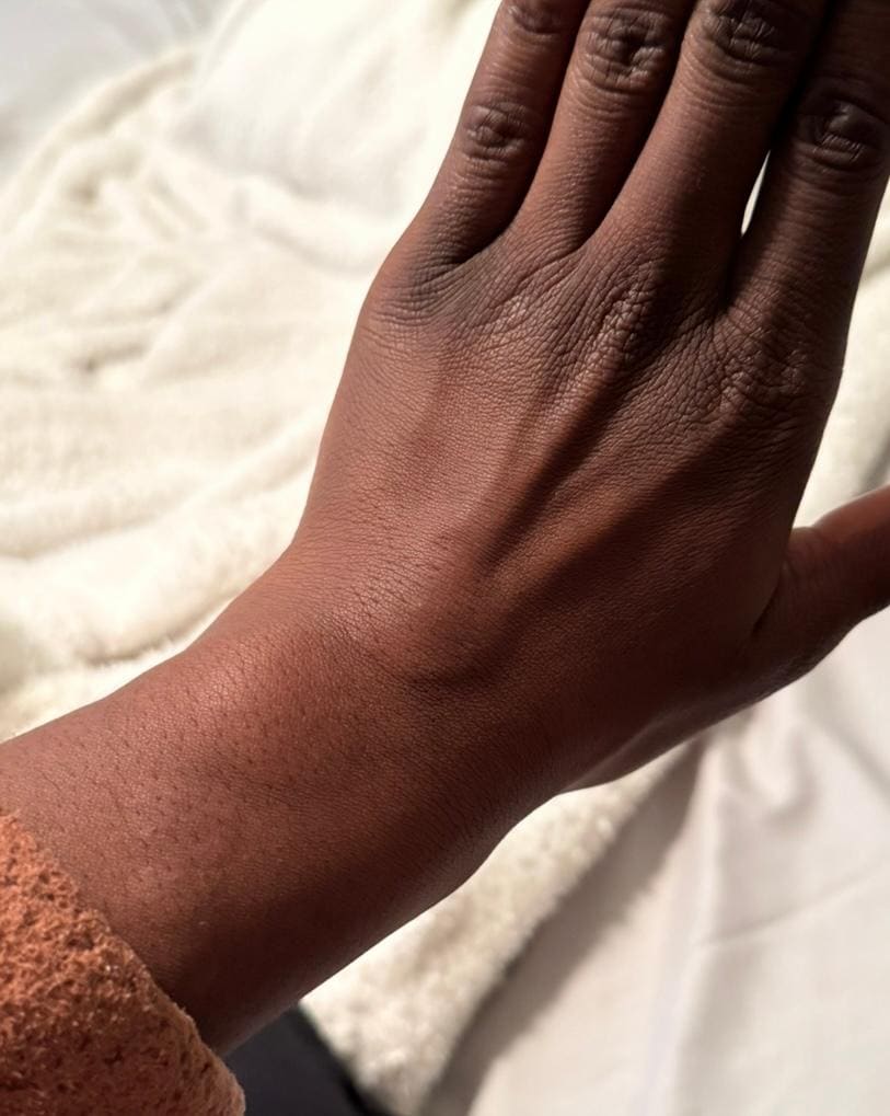 My hand swollen and itchy