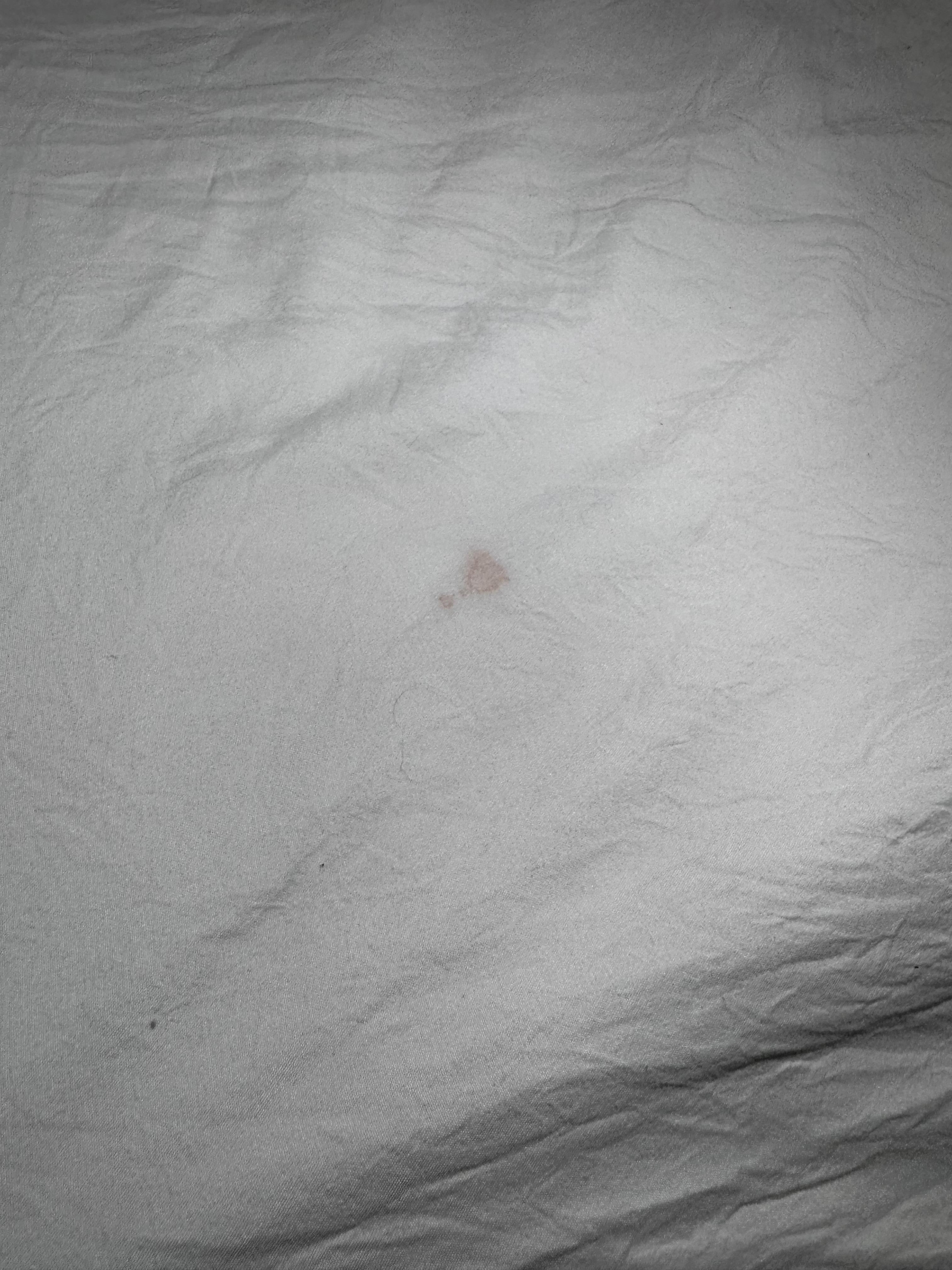 Blood stain or bodily fluid on sheets 