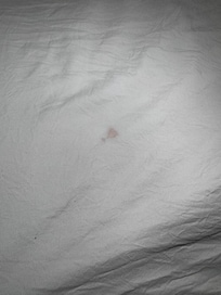 Blood stain or bodily fluid on sheets