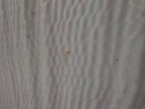 Toe nails clippings