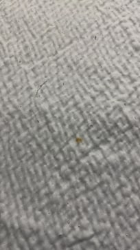 Stains on bedding