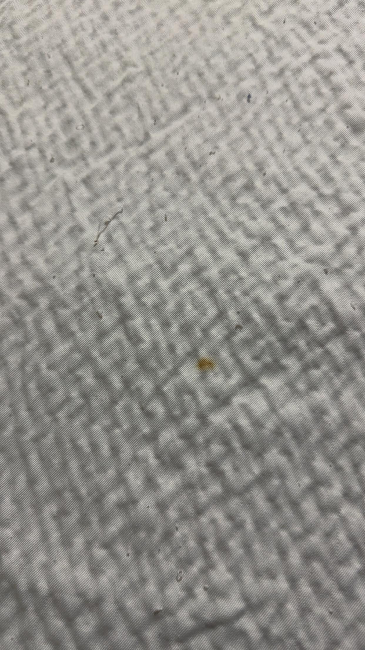 Stains on bedding