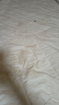 Stains on bed sheet.